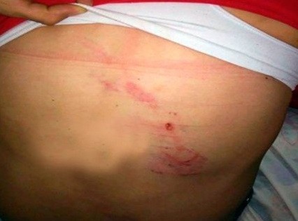 #NiUnaMenos Una mujer fue atacada a cadenazos por su sobrino político | Actualidad