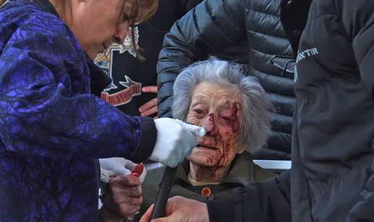 Ladrones golpearon brutalmente a una abuela de 91 años | Actualidad