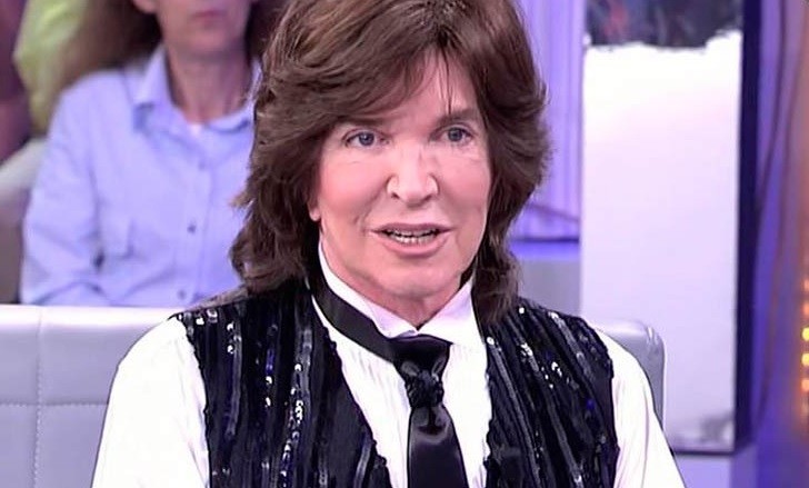 El nuevo rostro de Camilo Sesto alborota las redes sociales | Espectáculos