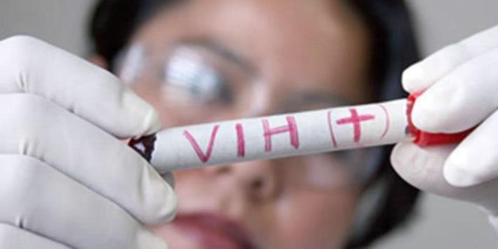 Descubren método para eliminar células con infección latente de VIH | Actualidad