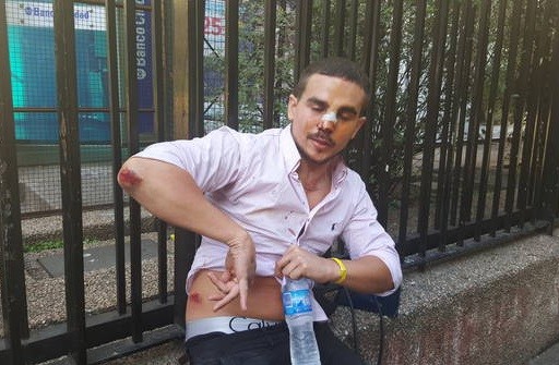 Denunció que patovicas de un boliche de Palermo lo golpearon hasta dejarlo inconsciente | Actualidad