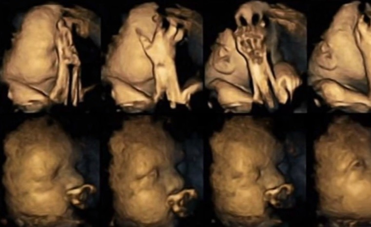 Logran captar la cara de sufrimiento de un feto cuando su madre fuma | Actualidad