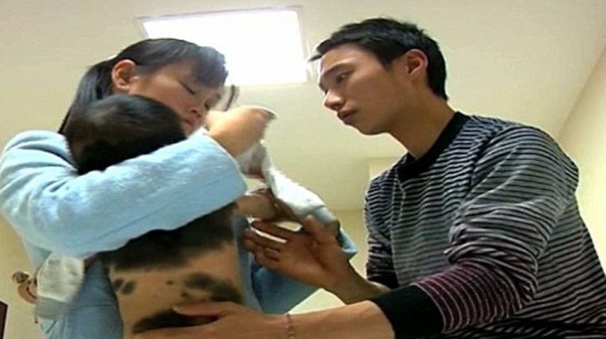 China: conmoción por un bebé que nació cubierto de pelos | Curiosidades