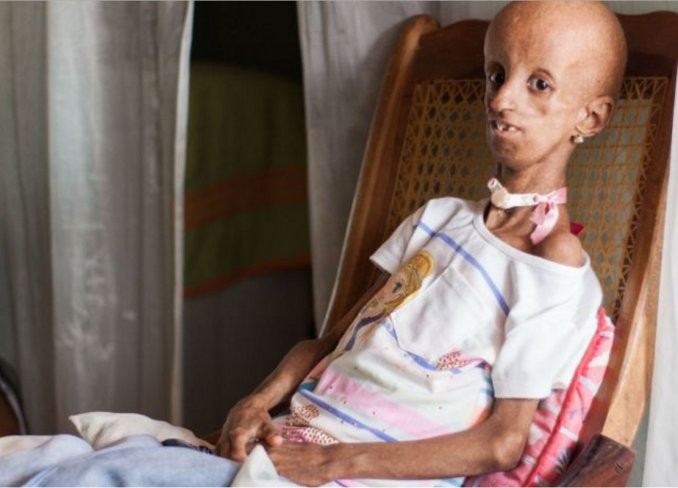 A pesar de su vejez prematura, festejó los 15 | Curiosidades