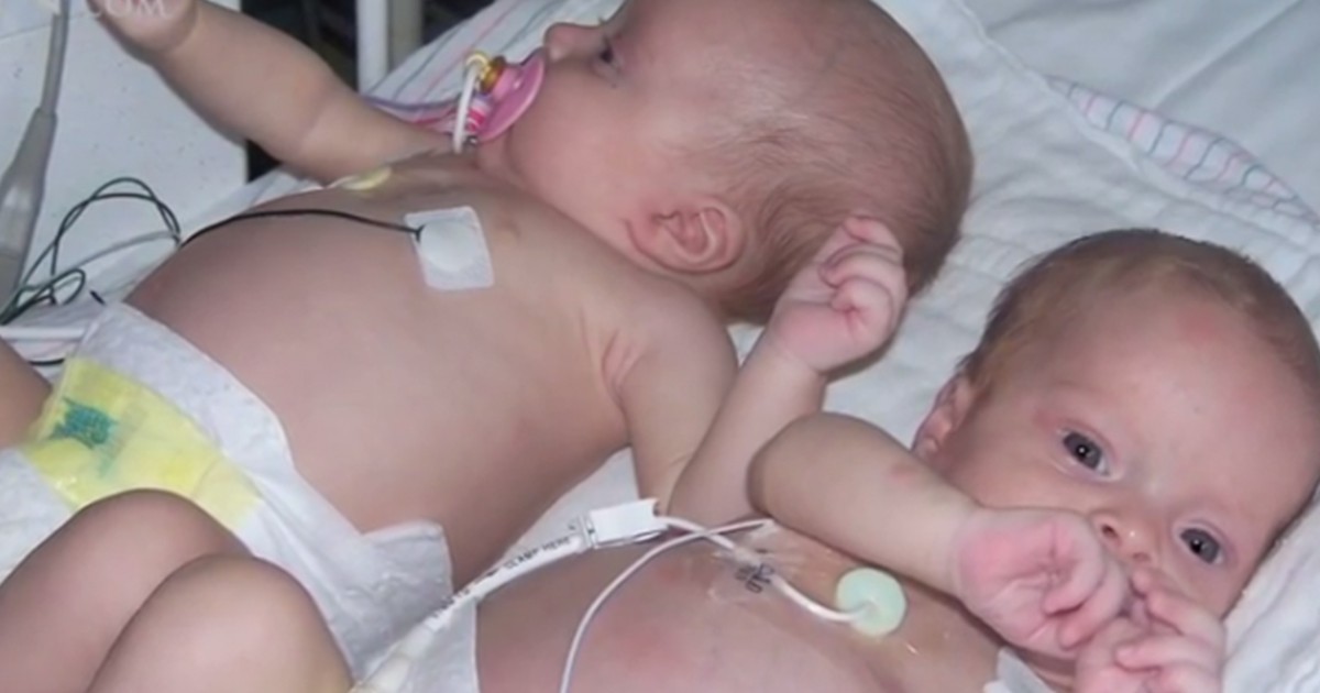 Isabella y Madelein, las gemelas bebés que le ganaron al cáncer | Internacionales