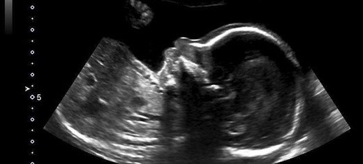 Le hicieron una ecografía y su bebé le envió un claro mensaje | Curiosidades