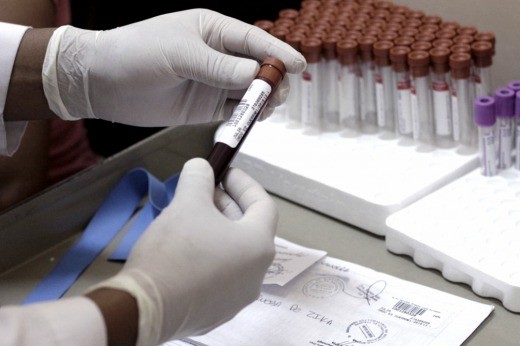 Confirmaron el primer caso autóctono de zika en la Argentina y creen que el contagio fue por vía sexual | Actualidad