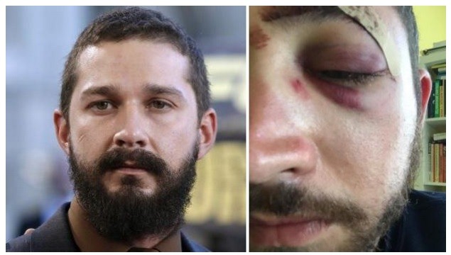 Le dieron una trompada y lo noquearon por parecerse a un actor | Curiosidades