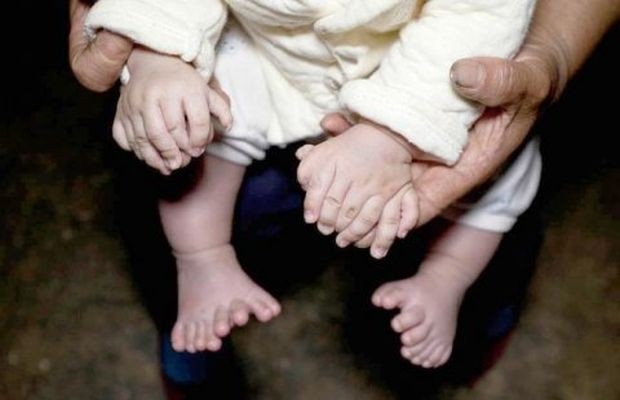 Familia de bebé con 31 dedos pide ayuda para operarlo | Internacionales