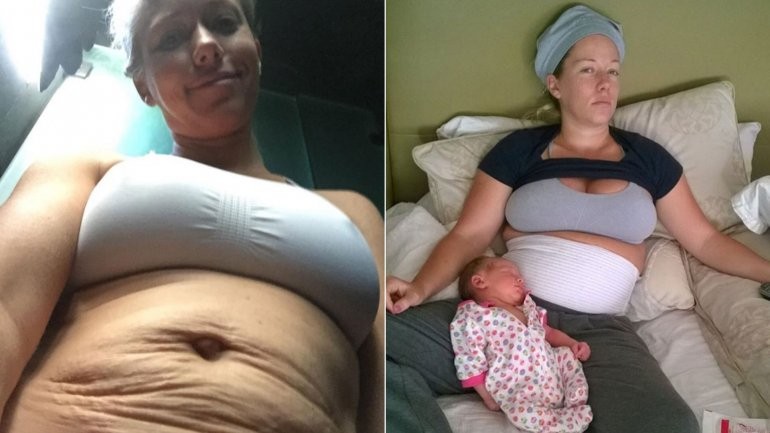 La ex conejita de Playboy que muestra sus estrías tras dos embarazos | Curiosidades