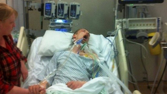 Foto impactante: la familia decidió mostrar los efectos de las "drogas legales" en un joven | Curiosidades