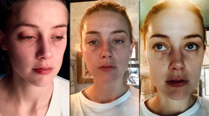 Aparecieron nuevas fotos de la ex esposa de Johnny Depp con golpes en la cara | Espectáculos