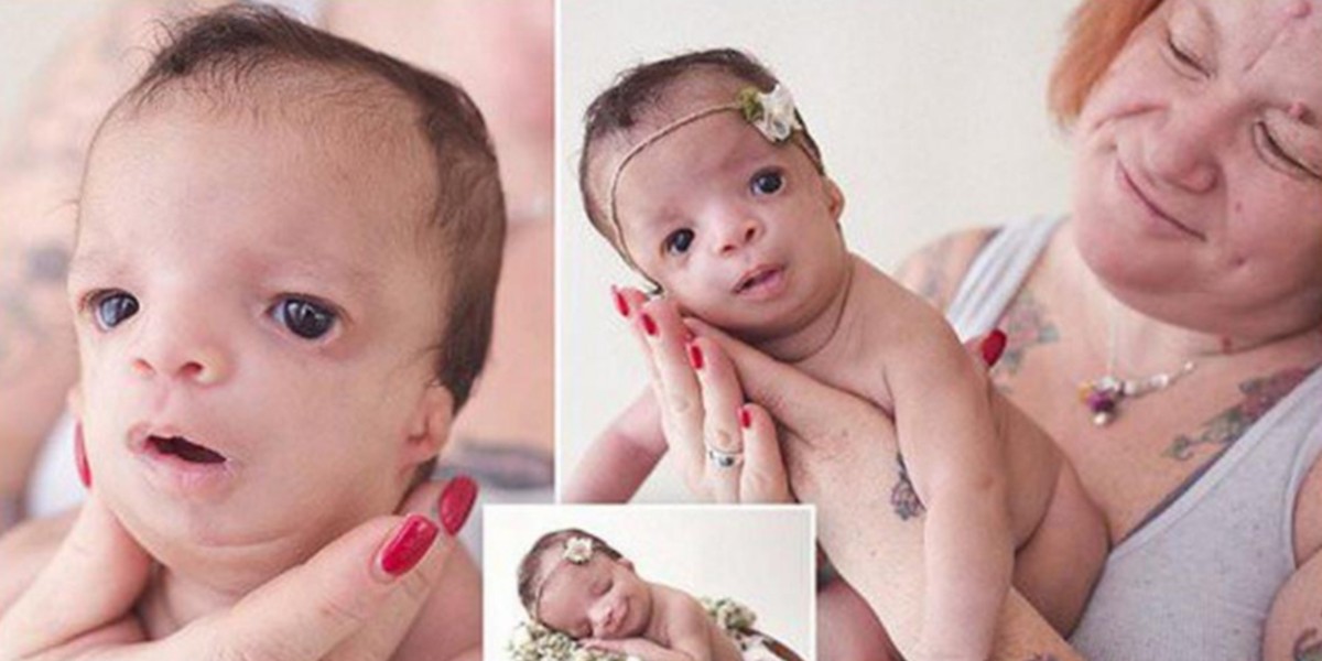 Padres adoptivos abandonaron a una bebé con malformaciones | Internacionales