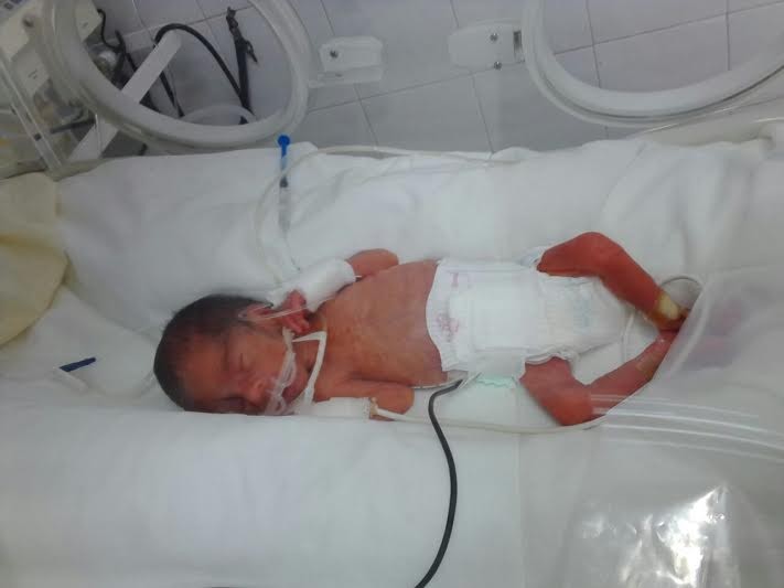 La historia del bebé al que resucitaron tras "nacer muerto" | Actualidad