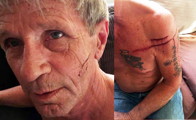 Así quedó el ex boxeador que se peleó con un oso en el bosque | Internacionales