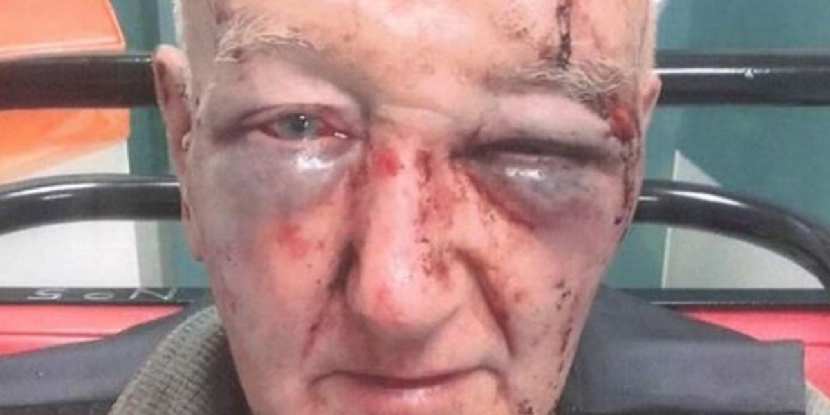 Brutal ataque a un hombre que le pidió a otro que no orine en la pared de su casa | Internacionales