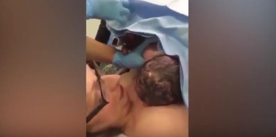 #EsViral El Impresionante video que muestra nacimiento de un bebé por cesárea "natural" | Redes