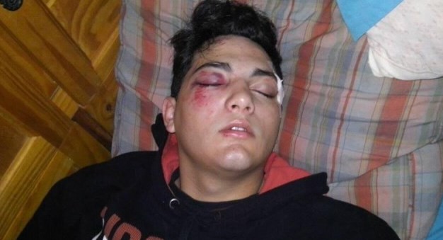 Brutal ataque a un joven en un colectivo: lo golpearon con un palo para robarle | Actualidad