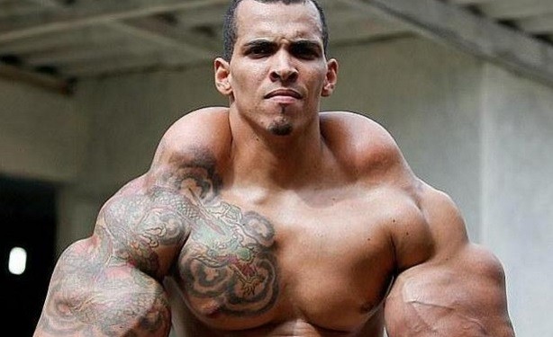 La historia del "Hulk humano" que se deshinchó para evitar la amputación de sus brazos | Curiosidades