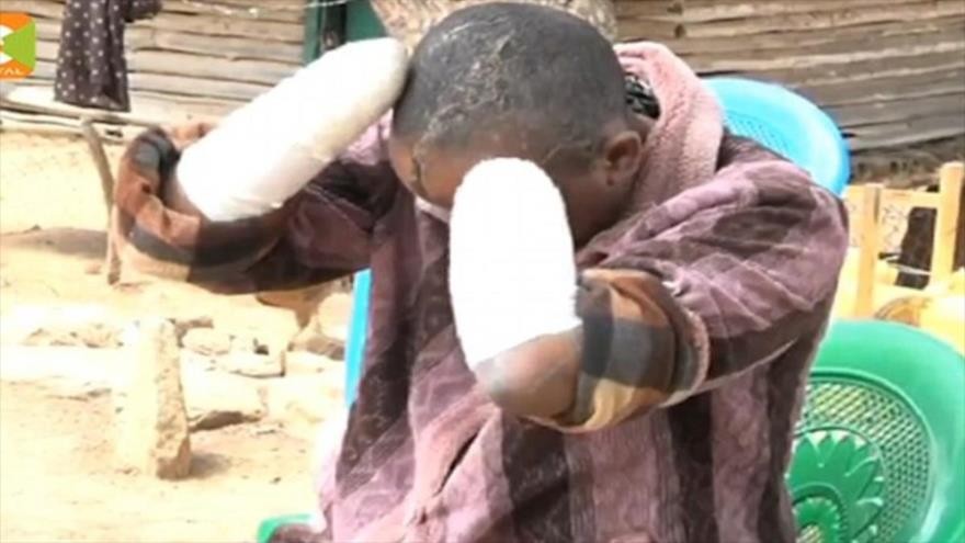 Como su mujer no quedaba embarazada, le cortó las manos con un machete | Internacionales