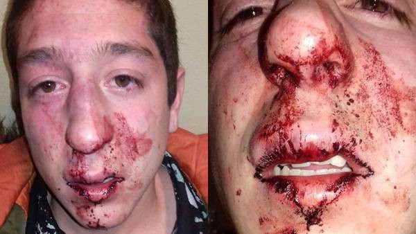 Patovicas le pegaron a un joven "por error" y ofrecieron entradas gratis como disculpas | Actualidad