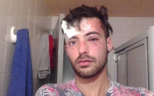 Lo golpearon por ser homosexual | Actualidad