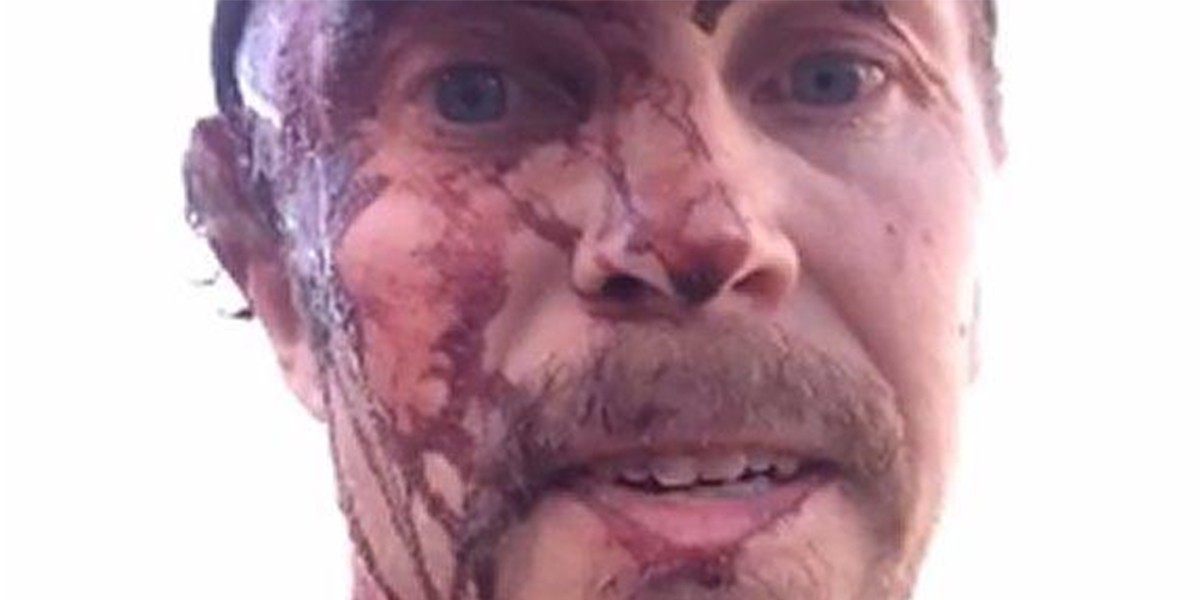 Así terminó el cazador que fue atacado dos veces por una osa | Redes