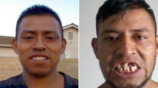 El jugador que se despertó del coma sin dientes y con una deuda de 100 mil dólares | Curiosidades