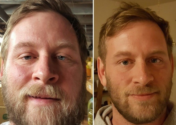 Las fotos del antes y después de un joven alcoholico en recuperación | Curiosidades