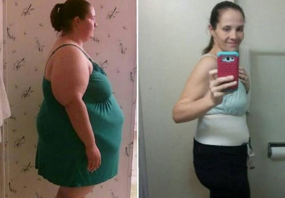 Bajó 100 kilos pero no quedó conforme: "Me veo como una vela derretida" | Redes