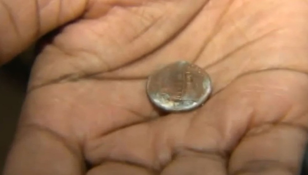 Un bebé pasó 37 días con una moneda en el cuerpo sin que los médicos se dieran cuenta | Curiosidades