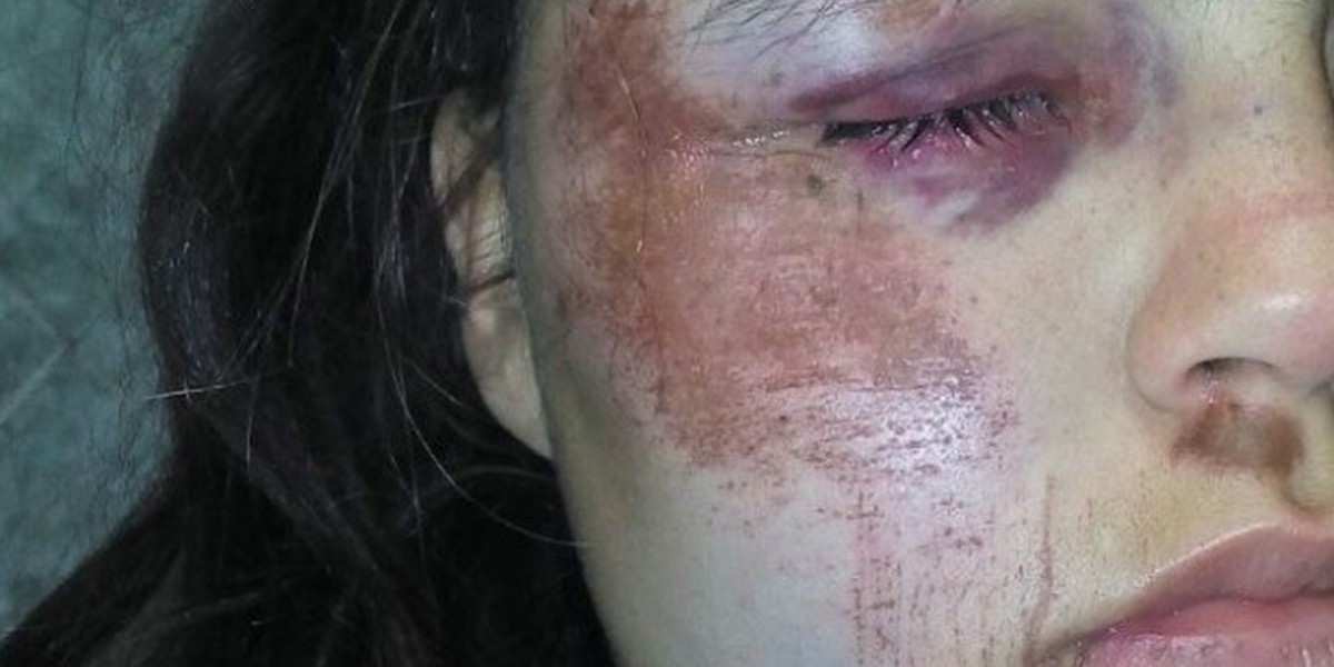 Denuncia que su ex la atacó junto a otras tres personas a la salida de un boliche | Actualidad