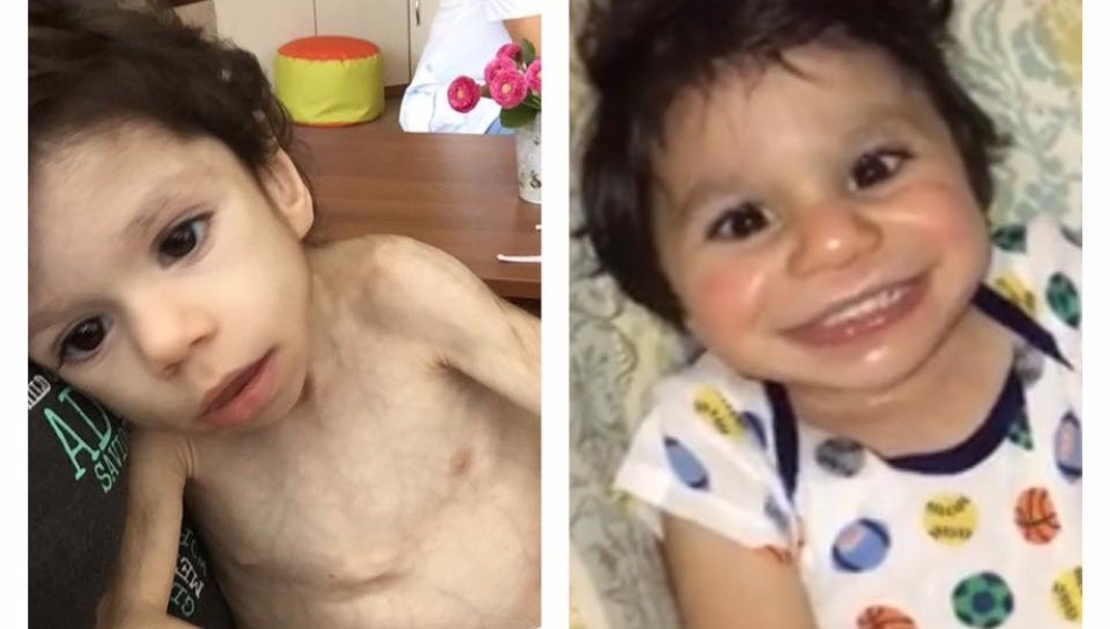 La increible recuperación de un nene de 7 años que pesaba 3 kilos y fue adoptado | Curiosidades