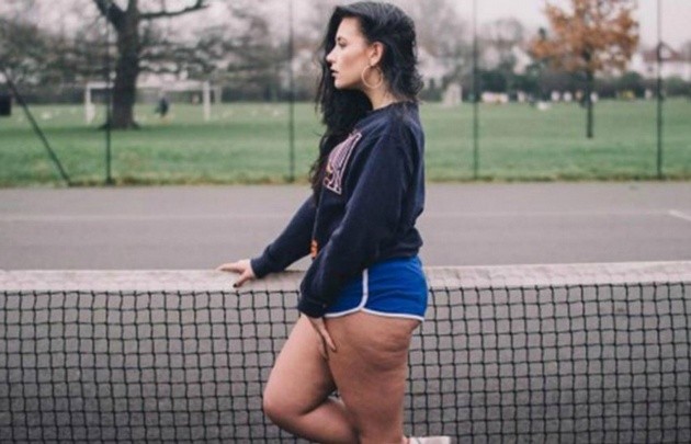 Fotos virales: mujeres que muestran sus celulitis | Redes