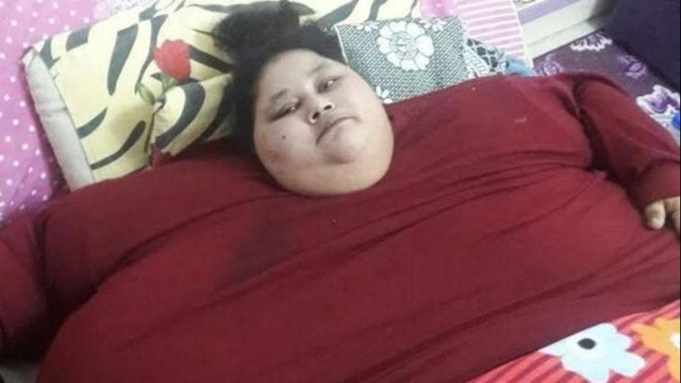 La mujer más obesa del mundo se opera para salvar su vida | Curiosidades