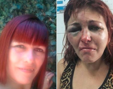 Escapó de la brutal golpiza de su pareja y se salvó de milagro | Actualidad