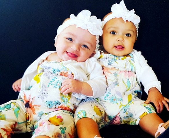 Son gemelas, pero con distinto color de piel: la emocionante historia de Kalani y Jarani | Redes