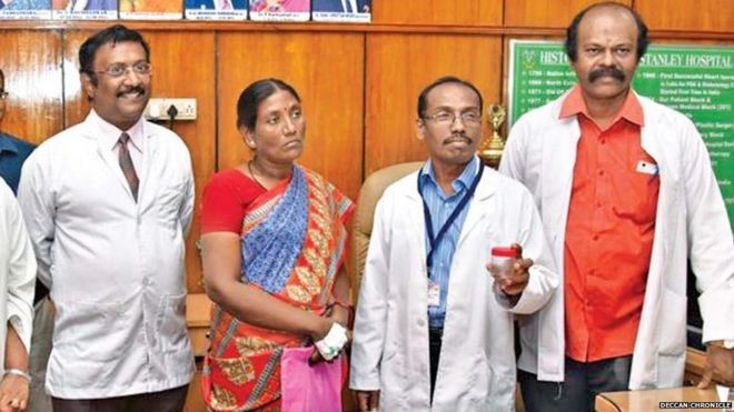 El relato de la mujer que tuvo una cucaracha en la cabeza: "Sentí que algo se movía" | Curiosidades