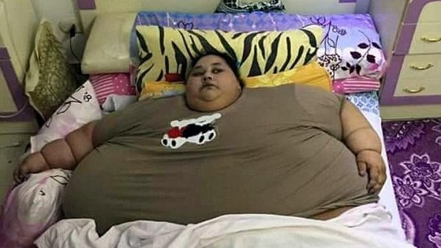 Pesa 500 kilos, es la mujer más gorda del mundo y será operada en India | Internacionales
