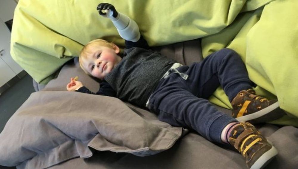 Un padre diseña e imprime una prótesis funcional para su bebé sin mano porque los médicos no se la querían dar | Internacionales