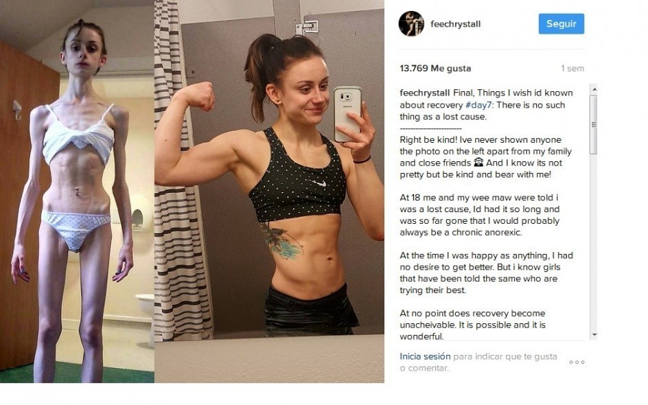 La historia de la chica que superó la anorexia y se convirtió en fanática de las artes marciales mixtas | Curiosidades