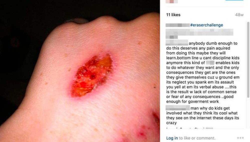 Alarma en Inglaterra por el peligroso "juego de la goma de borrar" | Curiosidades