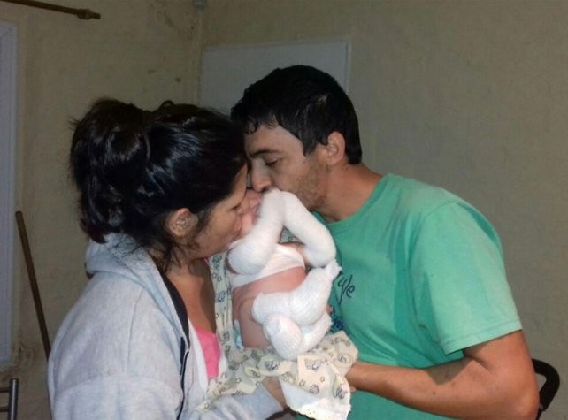 Un bebé que sufre "piel de cristal" conmueve a Mendoza | Actualidad