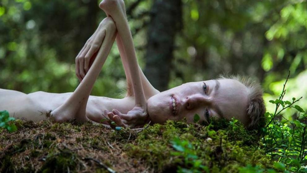 El político noruego con una enfermedad degenerativa que se animó a desnudarse para dar un mensaje de superación | Curiosidades