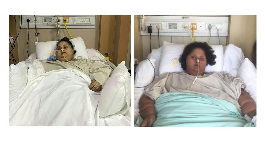 Mujer operada regresa a la India con 300 kilos menos | Internacionales