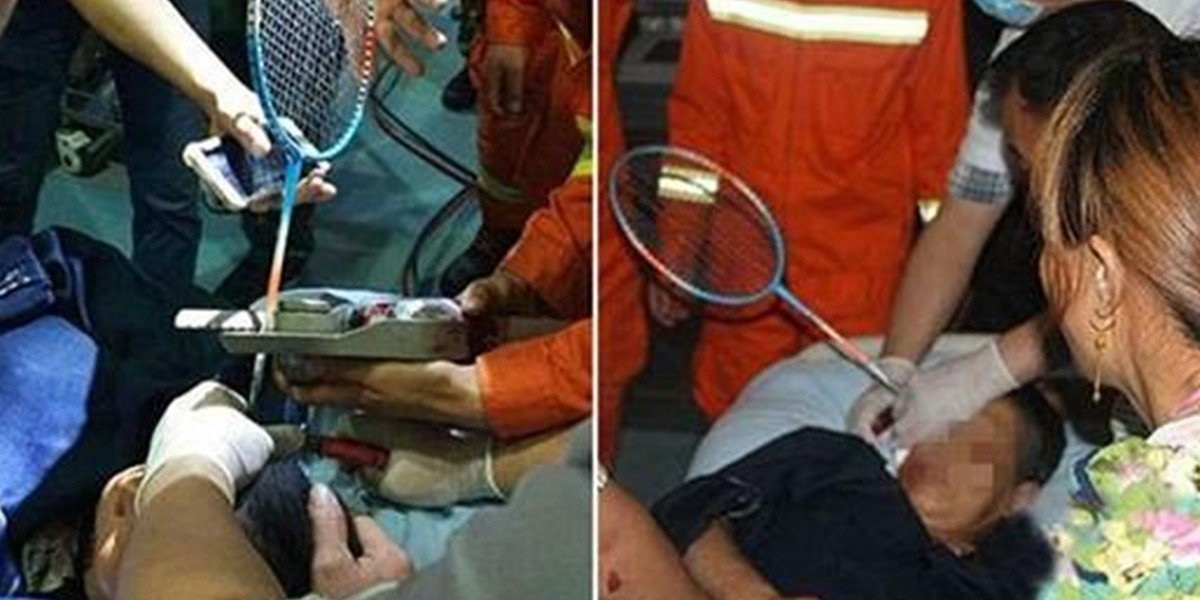 China: fue a ver jugar a su nieta y terminó con una raqueta incrustada en la cabeza | Internacionales