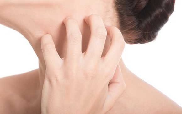 Campaña para detectar una rara enfermedad en la piel que afecta a medio millón de argentinos | Actualidad