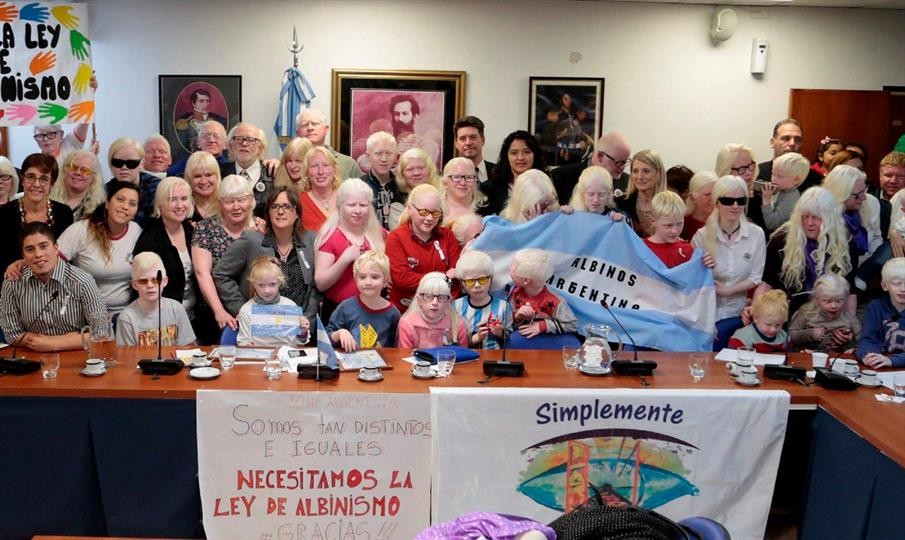 Albinismo: curiosidades, discriminación y un proyecto de ley esperanzador | Actualidad