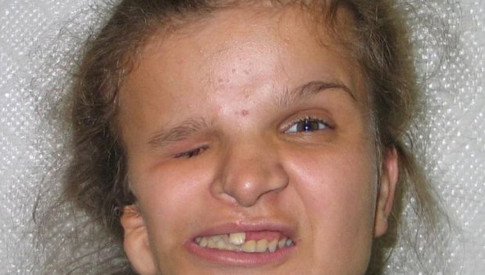 Una niña abandonada se somete a una operación de estética para volver con su familia y muere en el quirófano | Curiosidades