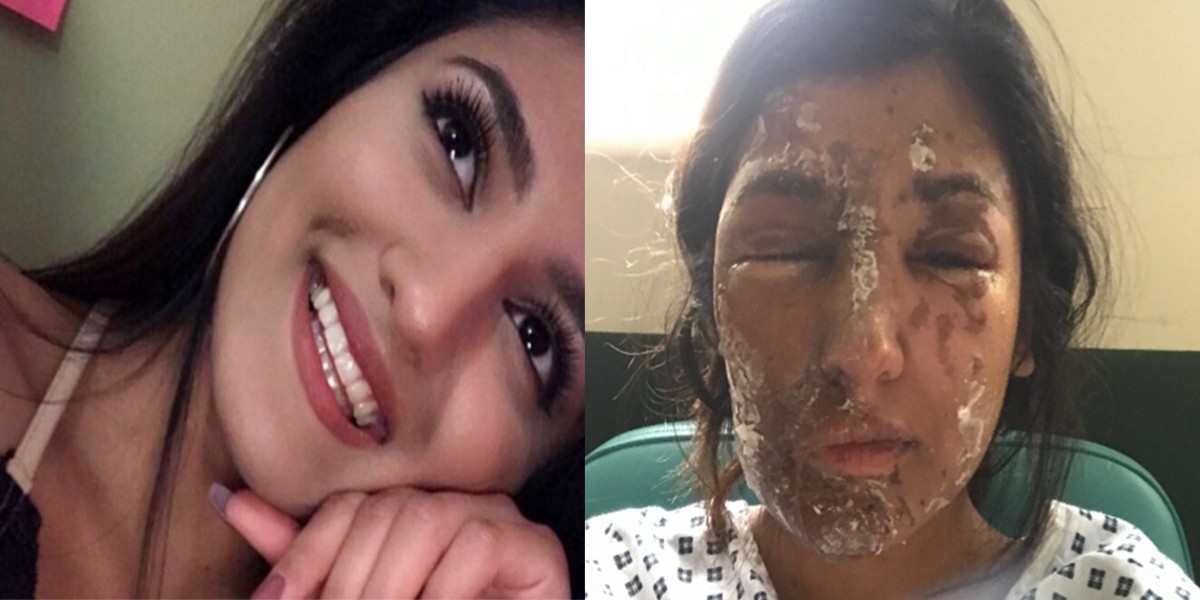 Le desfiguraron el rostro con ácido y sus amigos juntan dinero para la operación | Internacionales